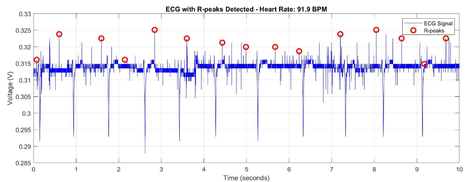 MATLAB plot of ECG with detected R-peaks at 91.9 BPM