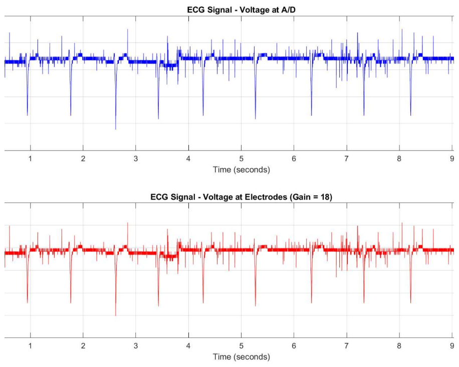 MATLAB plots showing ECG voltage at A/D and at electrodes